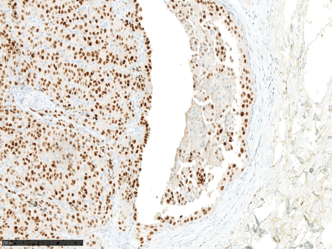 Immunohistochimie